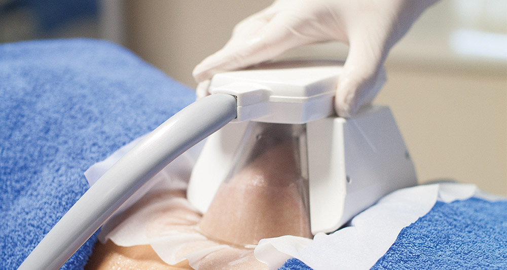 How Fat Freezing and HIFU Work Together? 2 Multiple Areas in One Session HIFU and Fat Freezing Romford