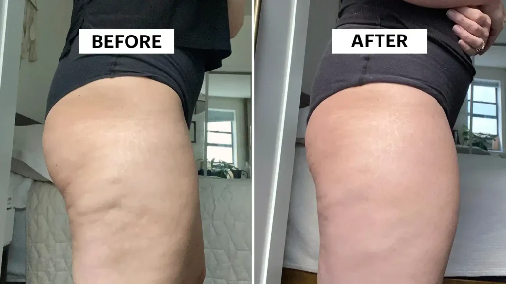 Sculpting Your Bum: Can Toning Exercises Really Reduce Cellulite? 1 Do Toning Exercise Romford Really Tackle Cellulite?