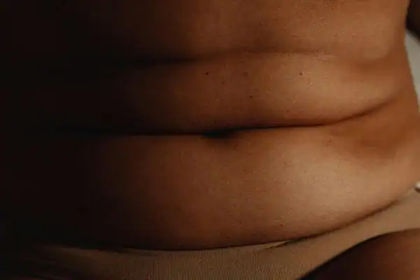 The Hidden Connection: How Stress Shapes Your Fitness and Body Composition 3 image of what stress can do on the stomach area and how Lipo 360 Romford can help to change your body shape.